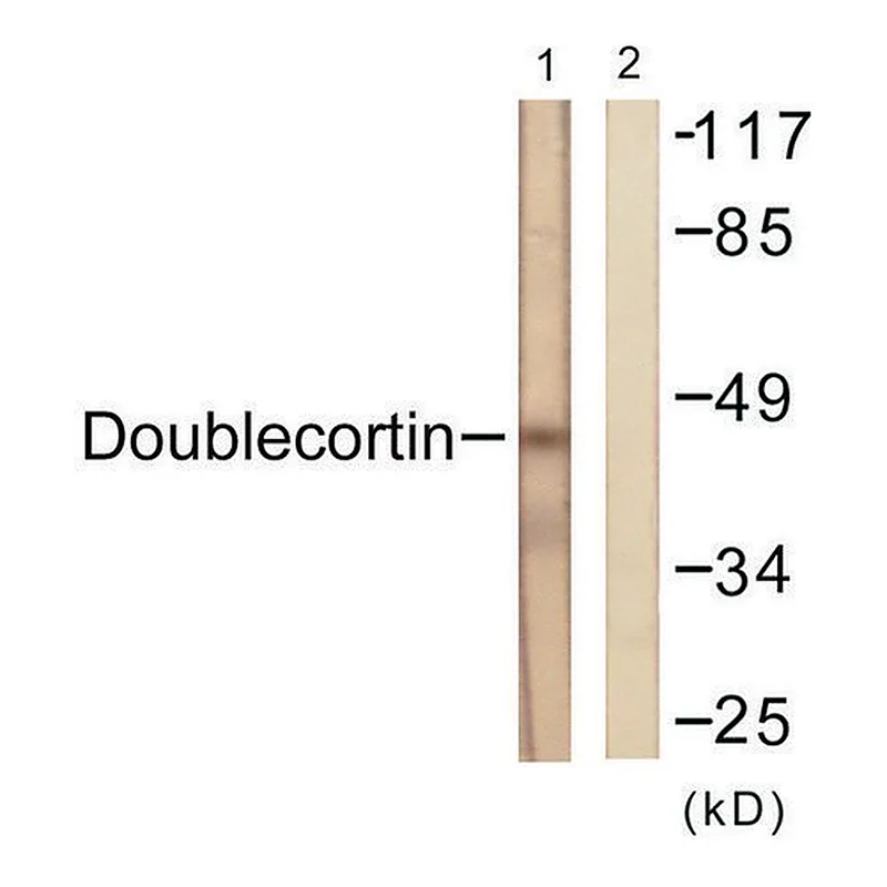 Merck Anti-Doublecortin antibody produced in rabbit