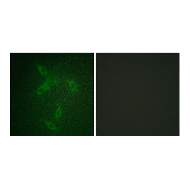 Merck Anti-JAK2 antibody produced in rabbit