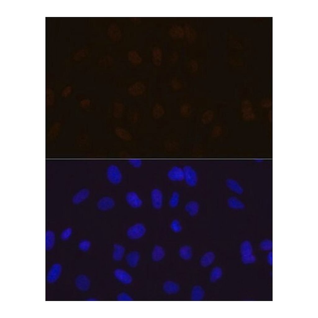 Merck Anti-MBNL1 antibody produced in rabbit