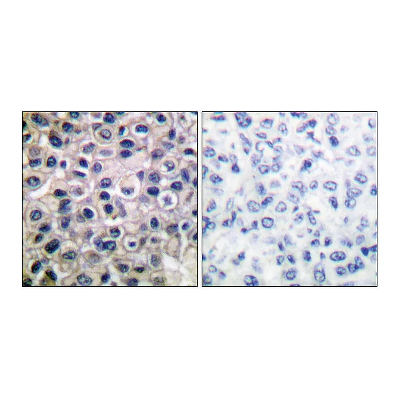 Merck Anti-MMP-14 antibody produced in rabbit