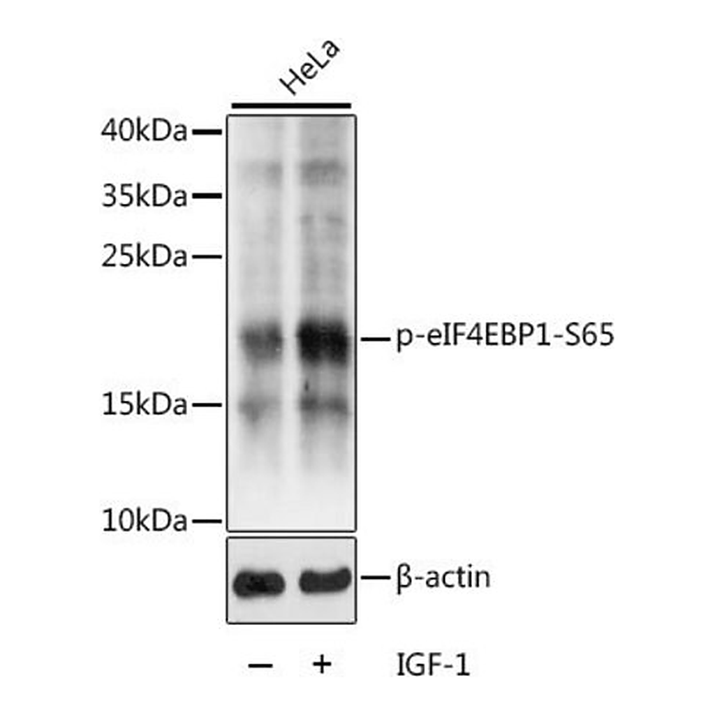 Merck Anti-Phospho-eIF4EBP1-S65 antibody produced in rabbit