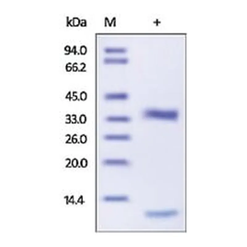 Merck CATHEPSIN L1,HUMAN