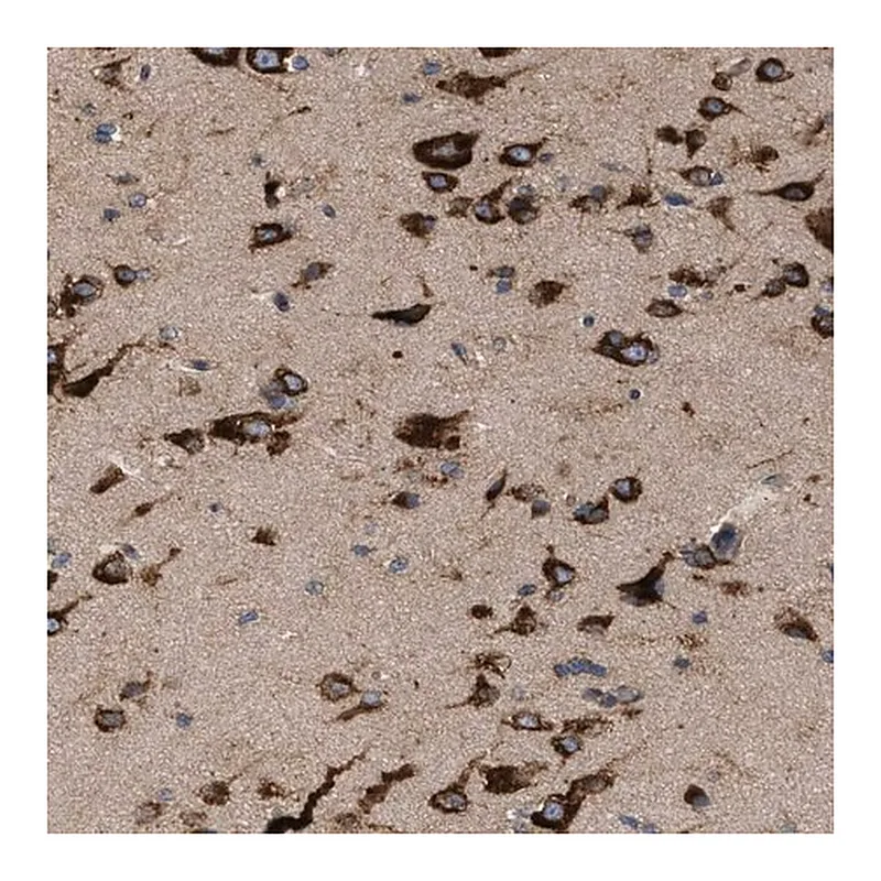 Merck Anti-IL1RL2 antibody produced in rabbit