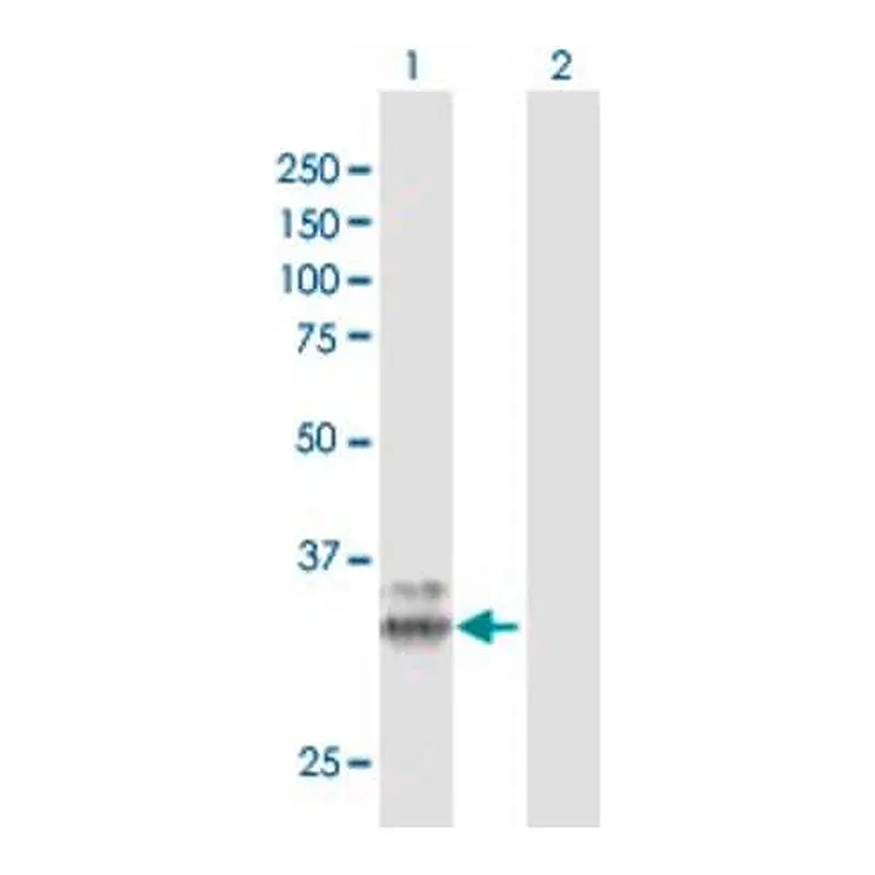 Merck Anti-PPT1 antibody produced in rabbit