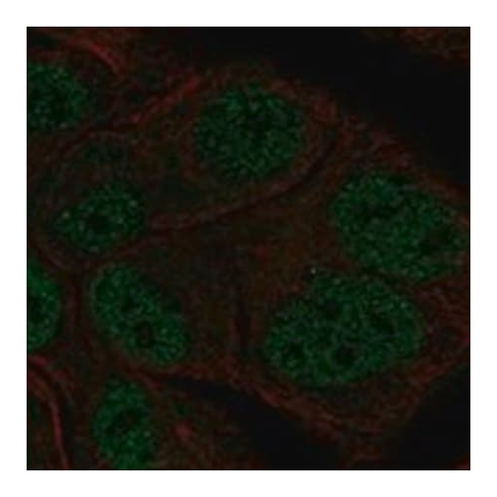 Merck Anti-TBL1Y antibody produced in rabbit