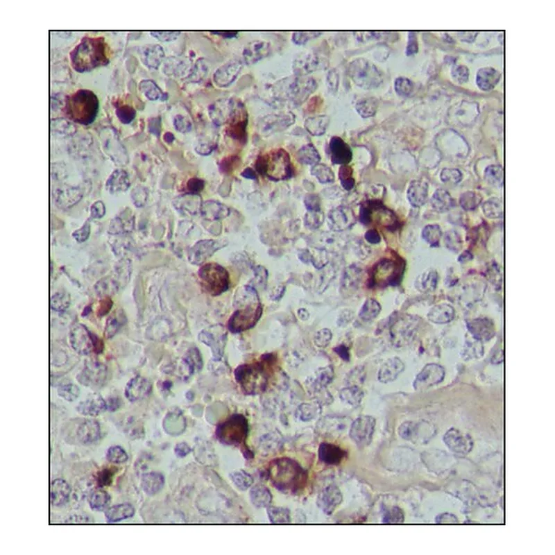 Merck Anti-Human IgA (alpha-chain specific)-Peroxidase antibody produced in goat