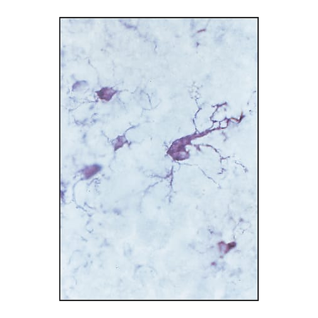 Merck Anti-Ferritin, Human antibody produced in rabbit