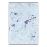 Merck Anti-Ferritin, Human antibody produced in rabbit