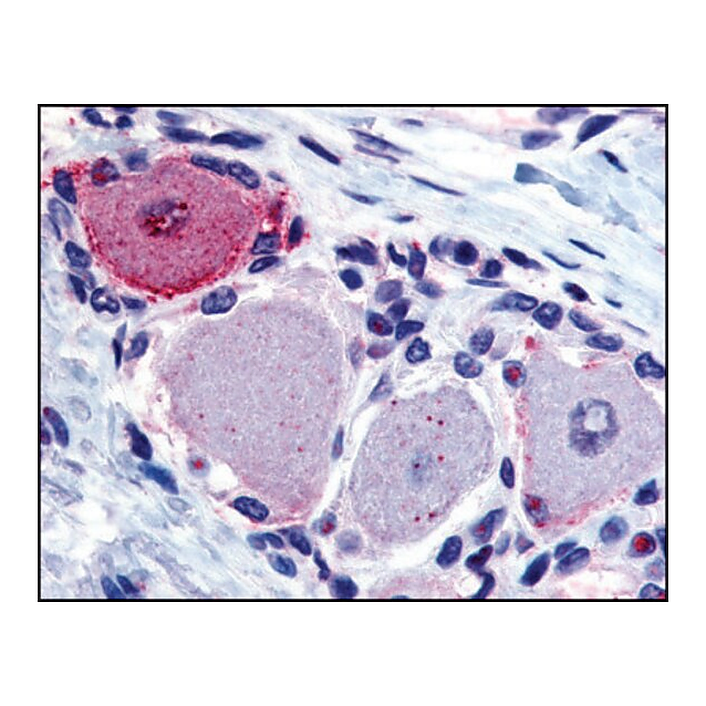 Merck Anti-MRGPRX2 (AB2) antibody produced in rabbit