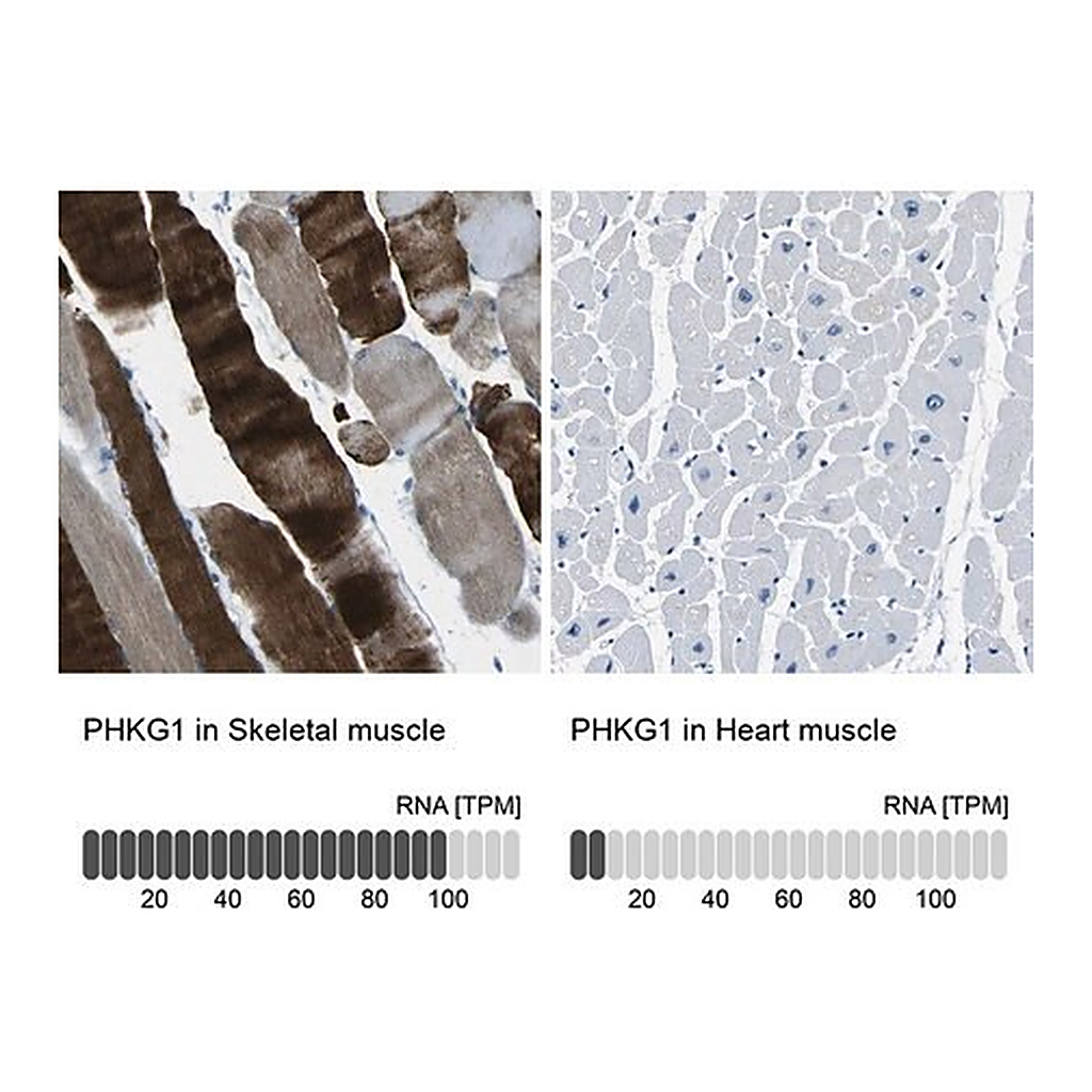 Merck Anti-PHKG1 antibody produced in rabbit