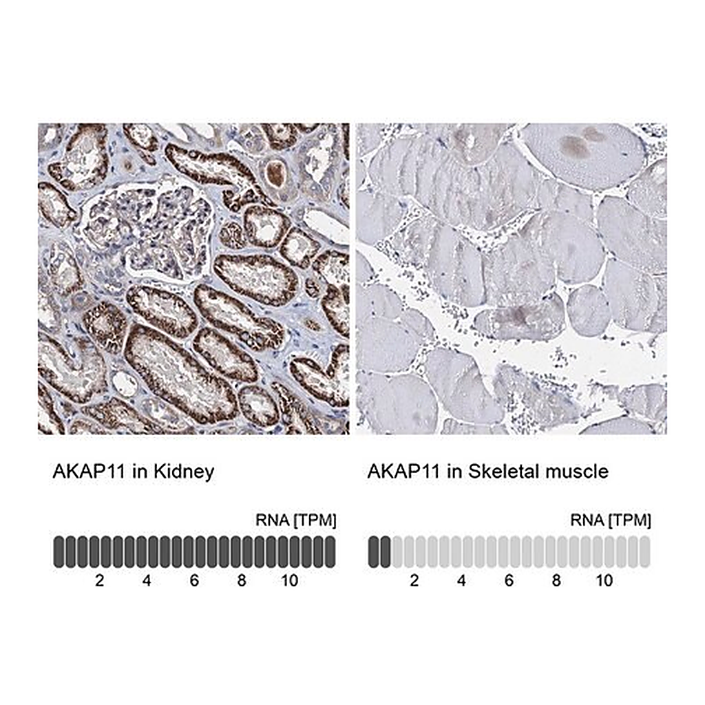 Merck Anti-AKAP11 antibody produced in rabbit