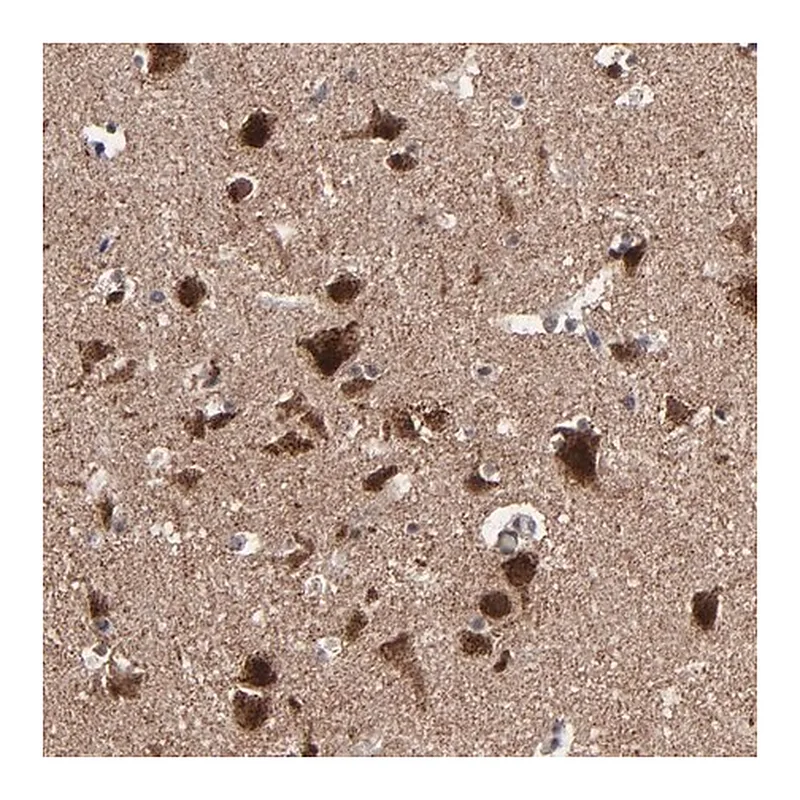 Merck Anti-BNIP3 antibody produced in rabbit