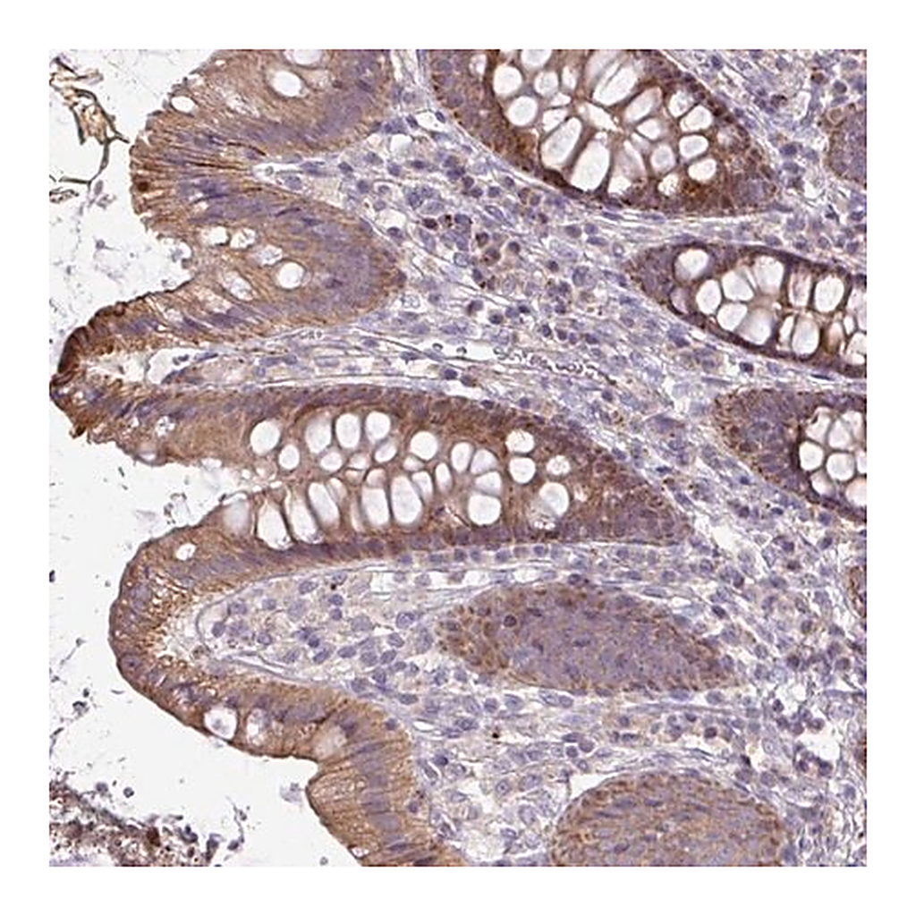 Merck Anti-STRIP1 antibody produced in rabbit