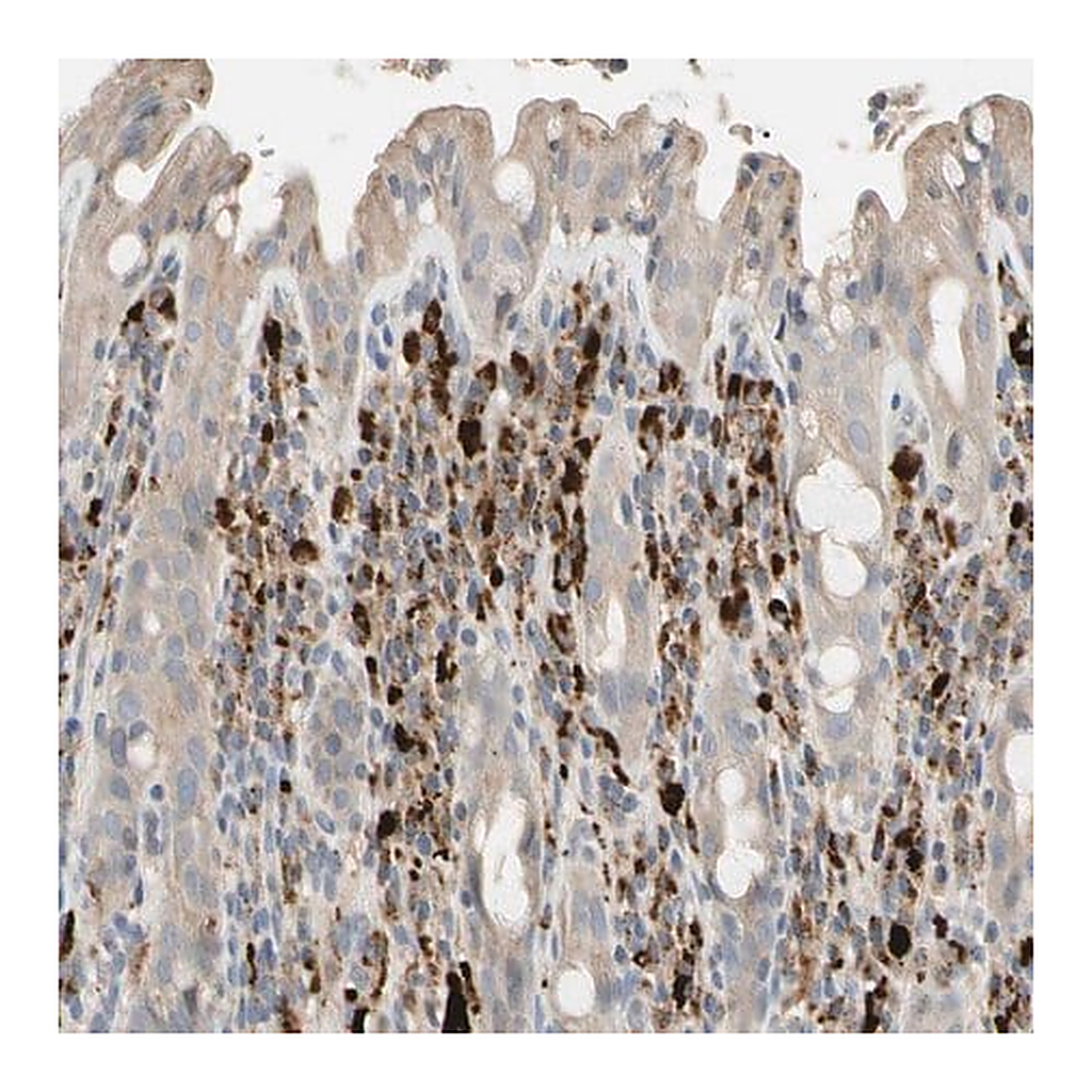 Merck Anti-CECR1 antibody produced in rabbit