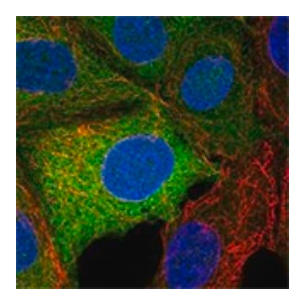Merck Anti-TRPM7 antibody produced in rabbit