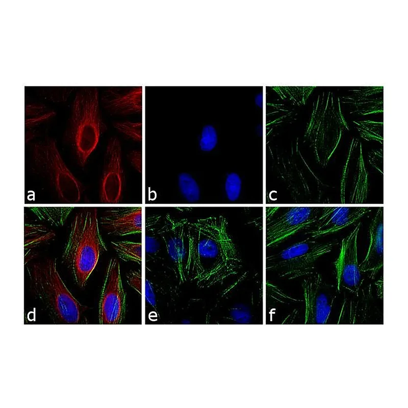 Thermo Fisher Scientific Goat anti-Mouse IgG1 Cross-Adsorbed Secondary Antibody, Alexa Fluor 633