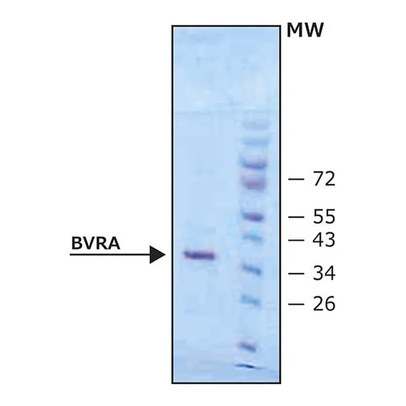Merck Biliverdin Reductase A human