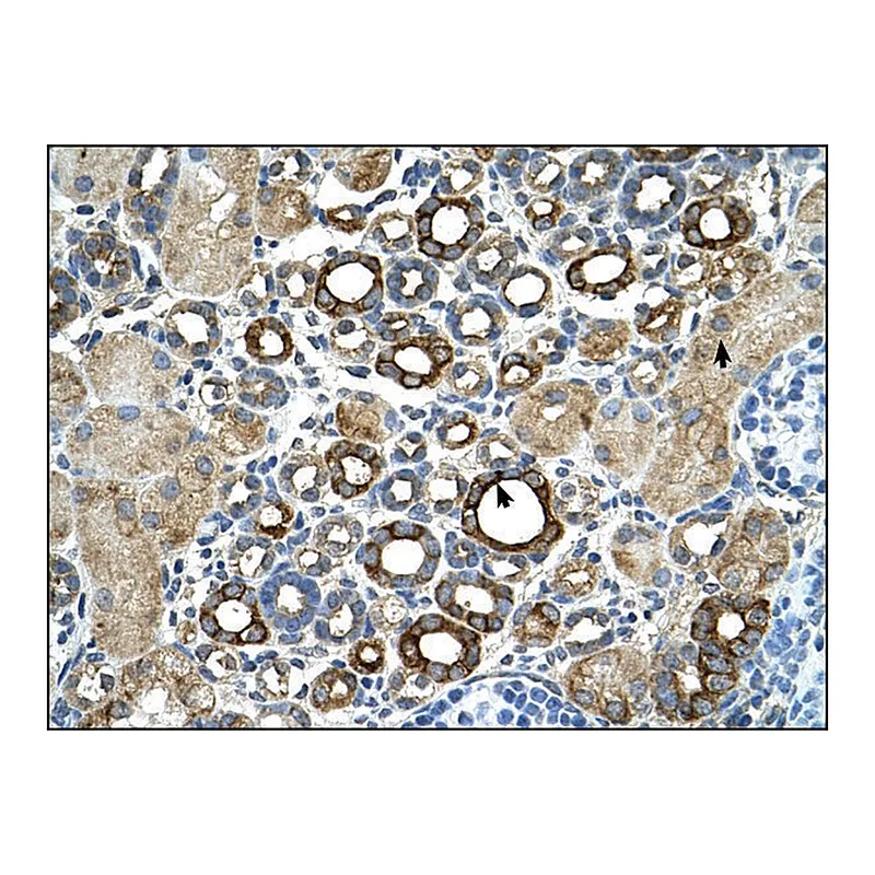 Merck Anti-ST14 antibody produced in rabbit