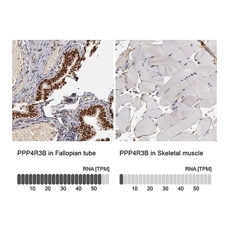 Merck Anti-PPP4R3B antibody produced in rabbit