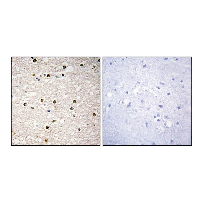 Merck Anti-P73 antibody produced in rabbit