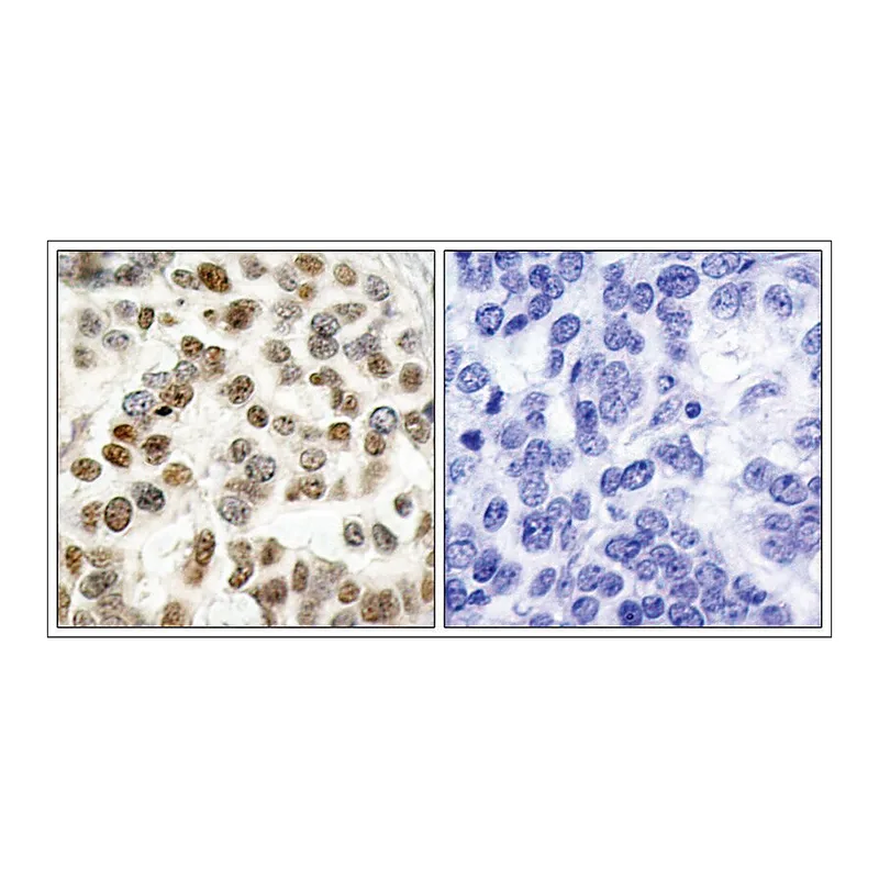 Merck Anti-BRCA1 (Ab-1423) antibody produced in rabbit