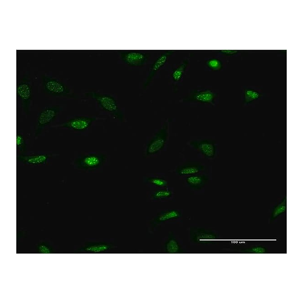 Merck Monoclonal Anti-OLIG2 antibody produced in mouse