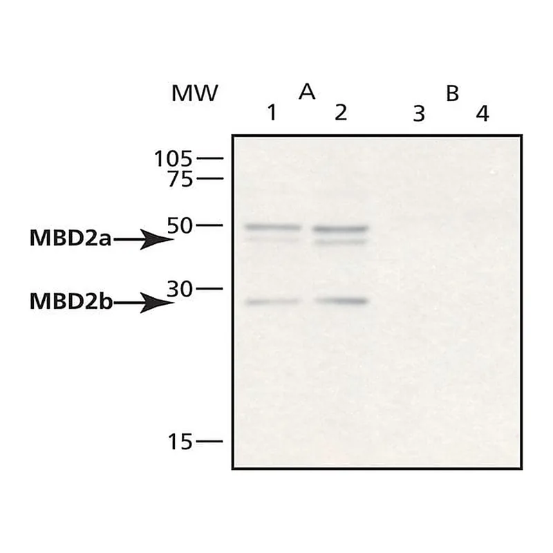 Merck Anti-MBD2a,b (RA-18) antibody produced in rabbit