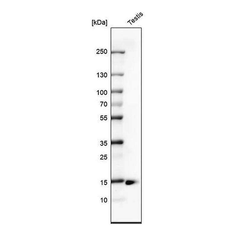 Merck Monoclonal Anti-CTAG1B antibody produced in mouse