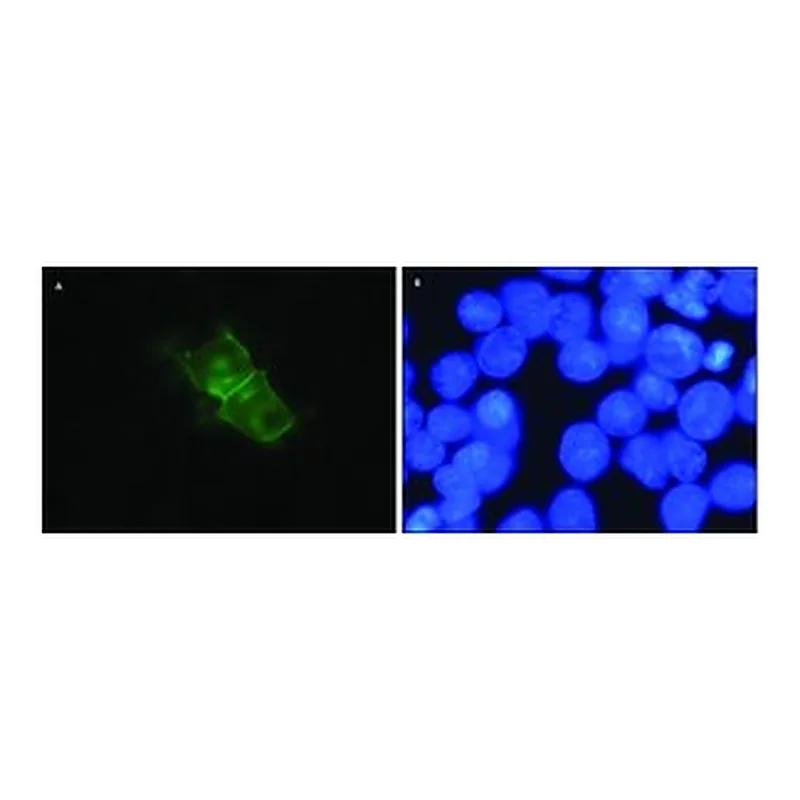 Merck ANTI-D SUB 1 /SUB DOPAMINE RECEPTOR AN&