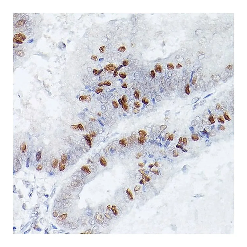 Merck Anti-RBPJK antibody produced in rabbit