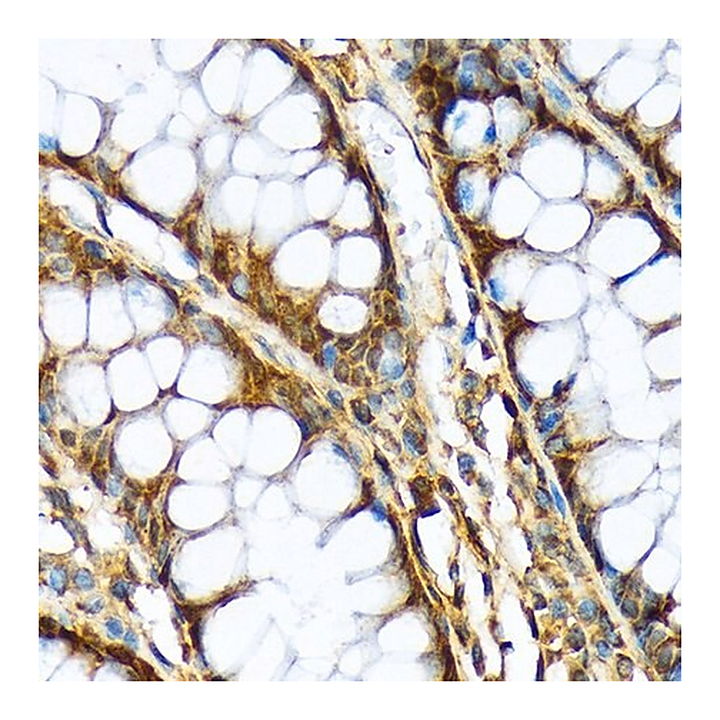 Merck Anti-ABCF1 antibody produced in rabbit