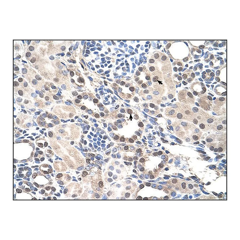 Merck Anti-RORA (AB3) antibody produced in rabbit