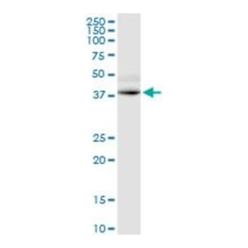Merck MONOCLONAL ANTI-GPRC5D