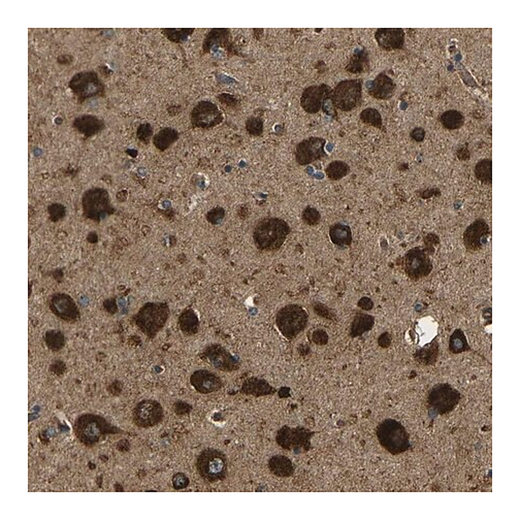 Merck Anti-ATP7A antibody produced in rabbit