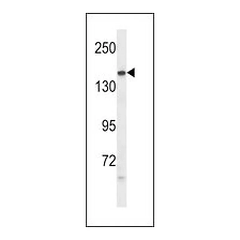 Merck ANTI-PTPRG (CENTER)