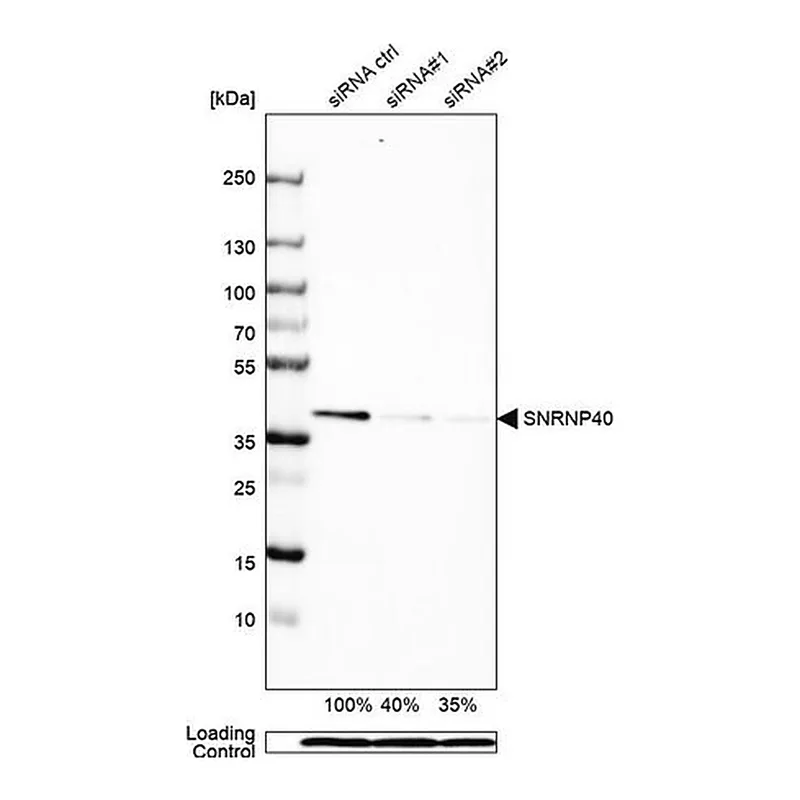 Merck Anti-SNRNP40 antibody produced in rabbit