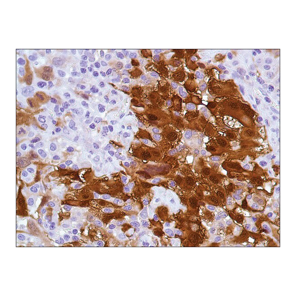Merck Anti-Calretinin antibody, Rabbit monoclonal