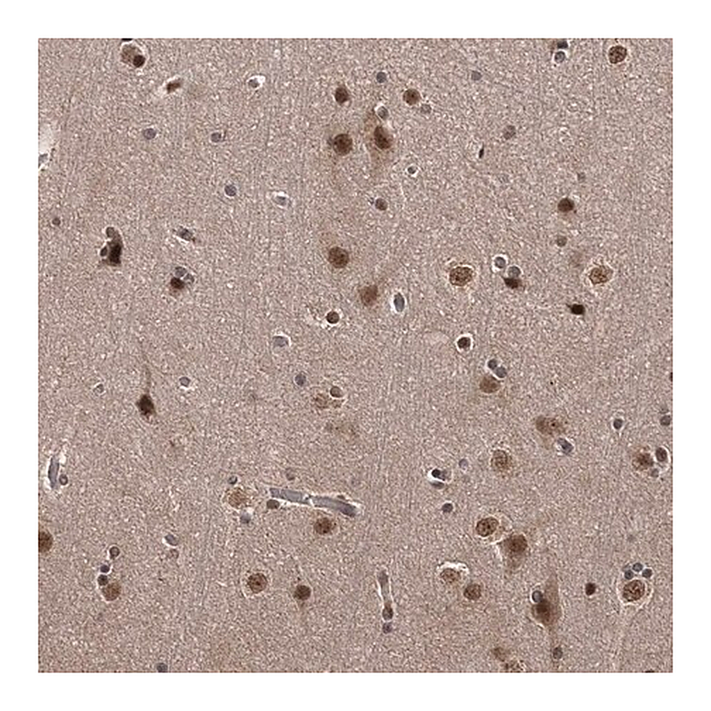 Merck Anti-TSHZ2 antibody produced in rabbit