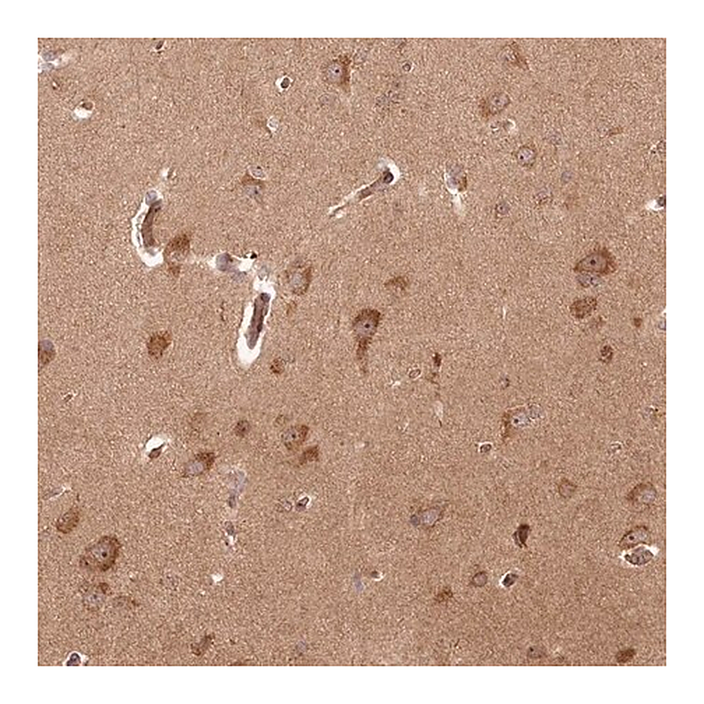 Merck Anti-ARL3 antibody produced in rabbit
