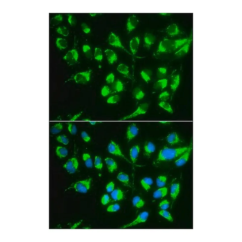 Merck Anti-SLC22A5 antibody produced in rabbit