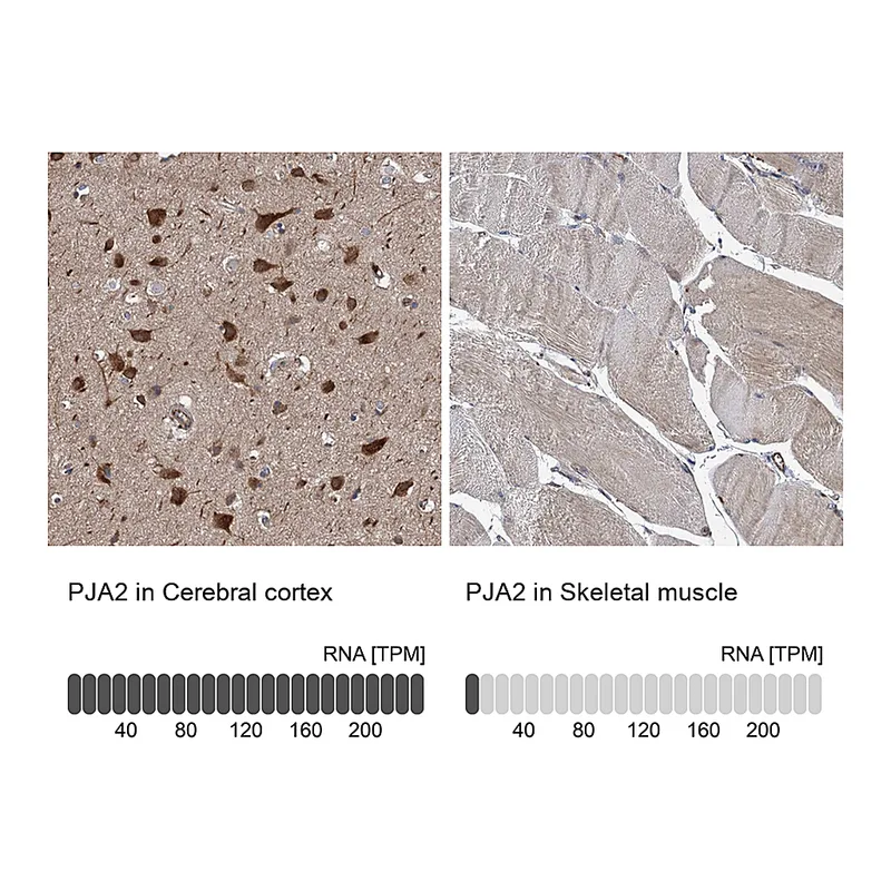 Atlas Antibodies Anti-PJA2 Antibody