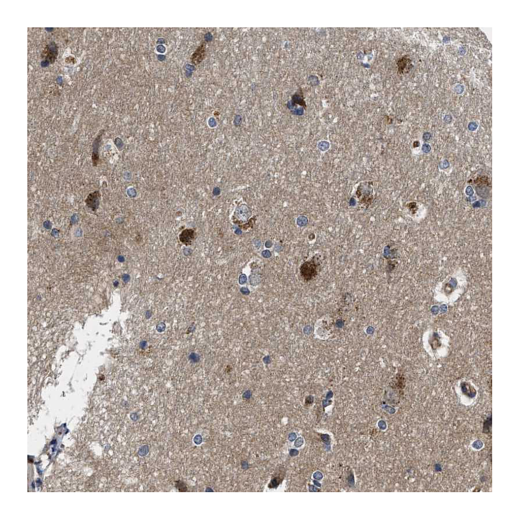 Atlas Antibodies Anti-PKD2 Antibody