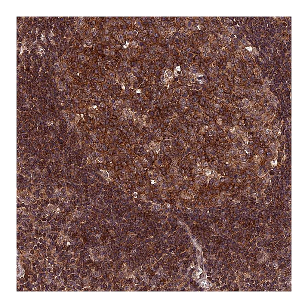 Atlas Antibodies Anti-PKD2L2 Antibody