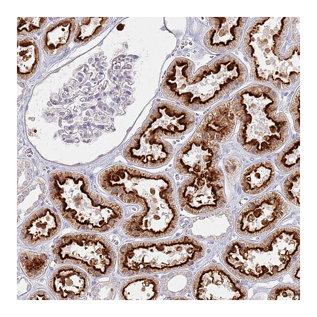 Atlas Antibodies Anti-PKD2L2 Antibody