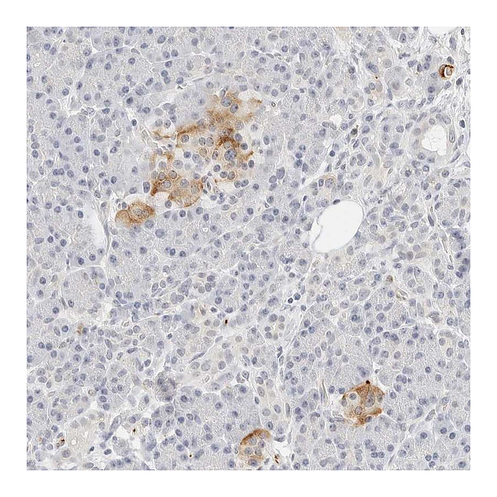 Atlas Antibodies Anti-PKDCC Antibody