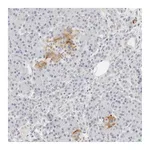 Atlas Antibodies Anti-PKDCC Antibody