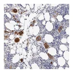 Atlas Antibodies Anti-PKDCC Antibody