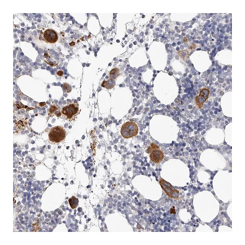Atlas Antibodies Anti-PKDCC Antibody