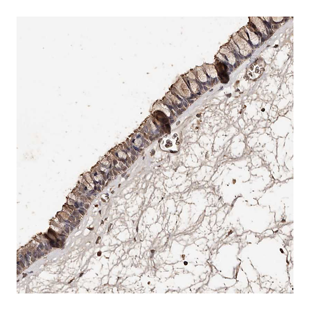 Atlas Antibodies Anti-PKDCC Antibody