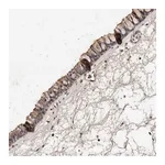 Atlas Antibodies Anti-PKDCC Antibody